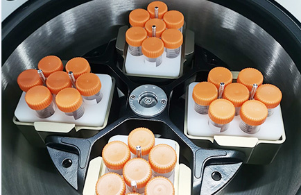 Como escolher o tubo de centrífuga