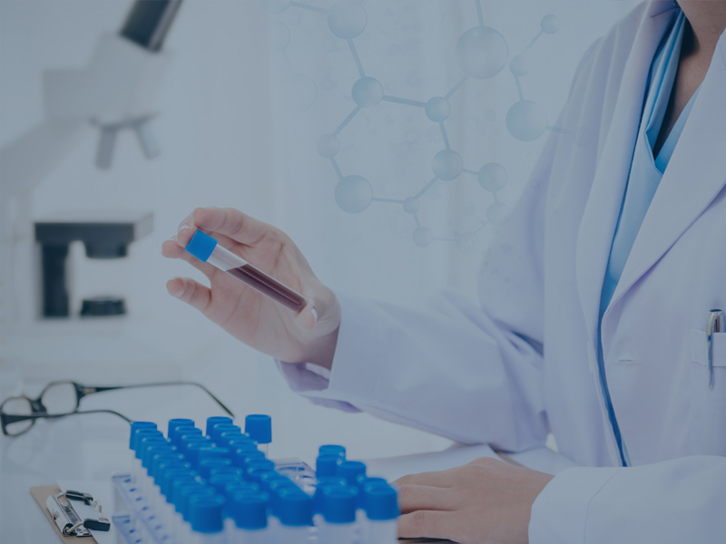 Centrifugador de cito usado em imunofenotipagem