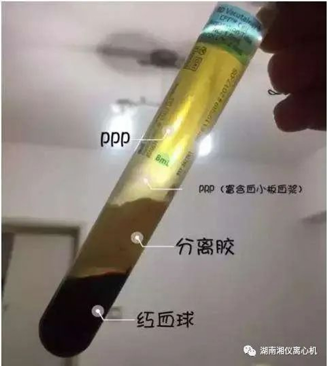 【Popularização da ciência】 PRP Autóloga Soro Beleza